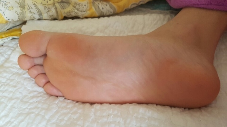 Kteensfeet cover image