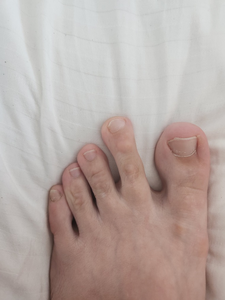 UGLY_FEET_FETISH cover image