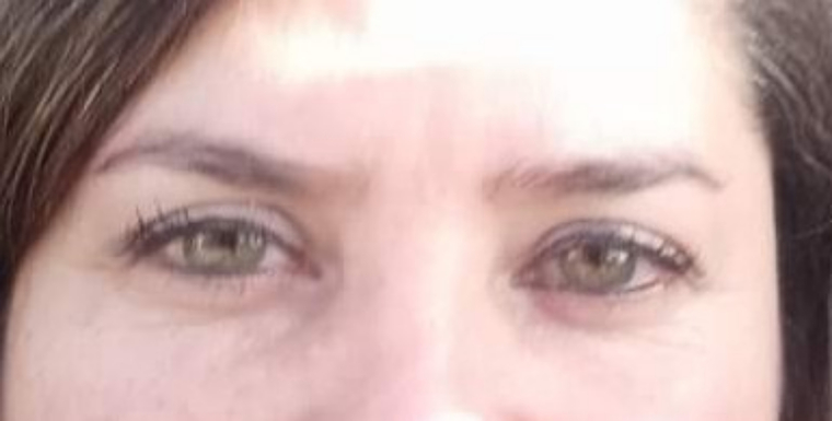 Labios de rubi banner image
