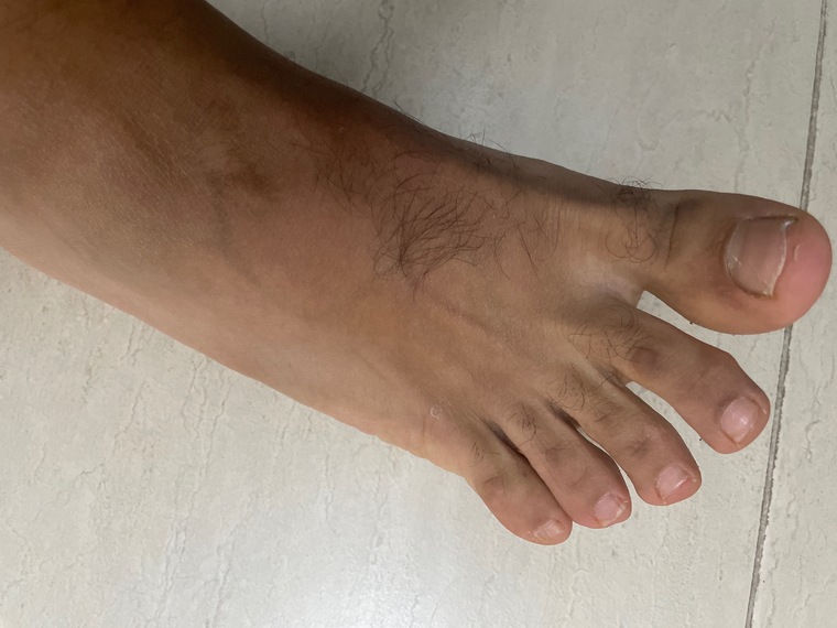 Legs banner image