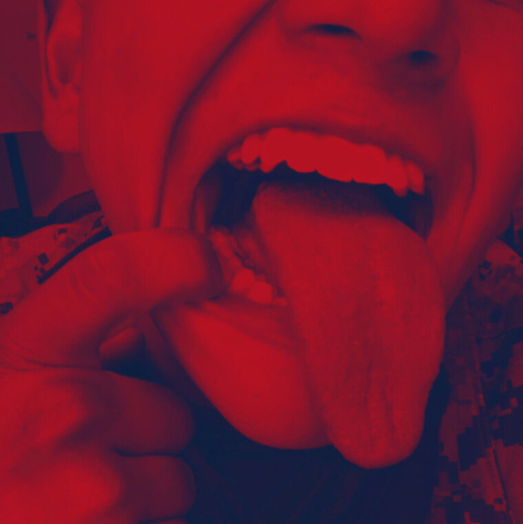 Guz cover image