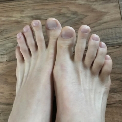 livinggayfeet avatar