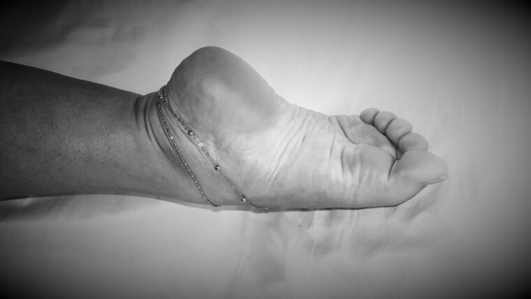 Lynda Beautiful Feet banner image