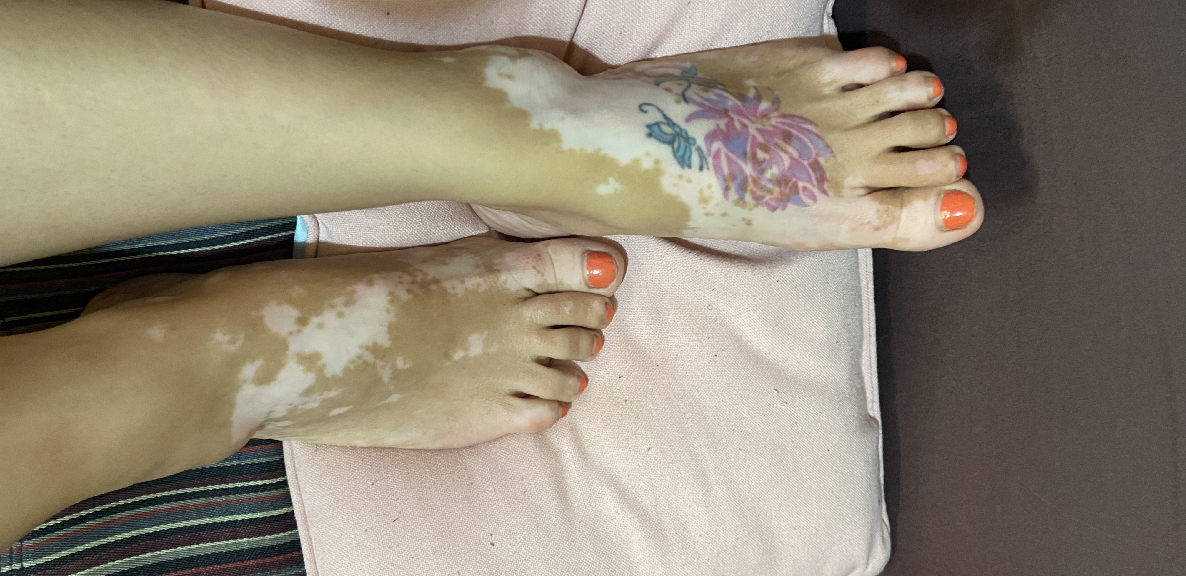 Vitiligo Mama avatar