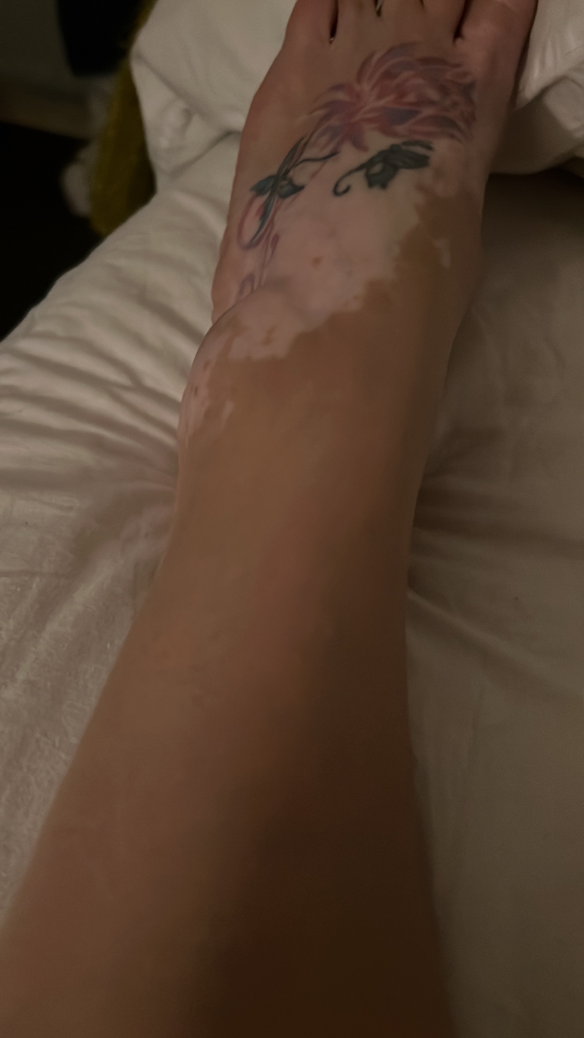 Vitiligo Mama banner image