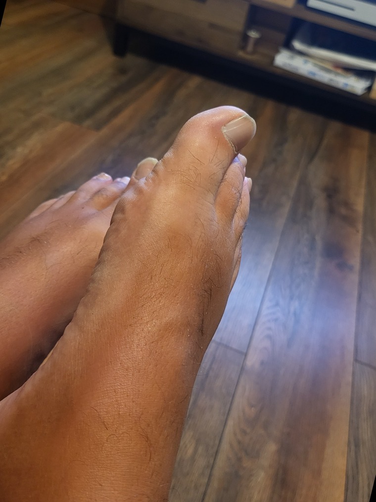 Male feet cover image