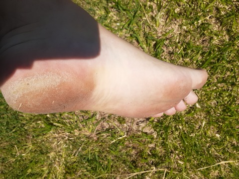 ManBears Feet cover image