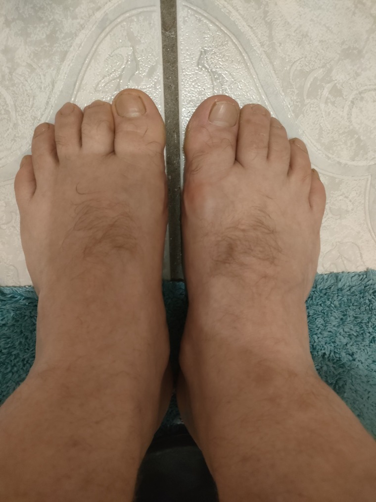 Big feets banner image