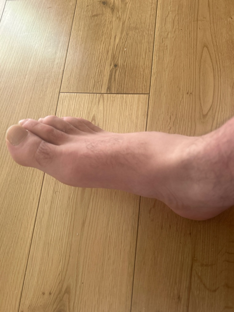 Manhairyfeet banner image