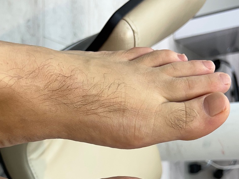 MR Foot cover image