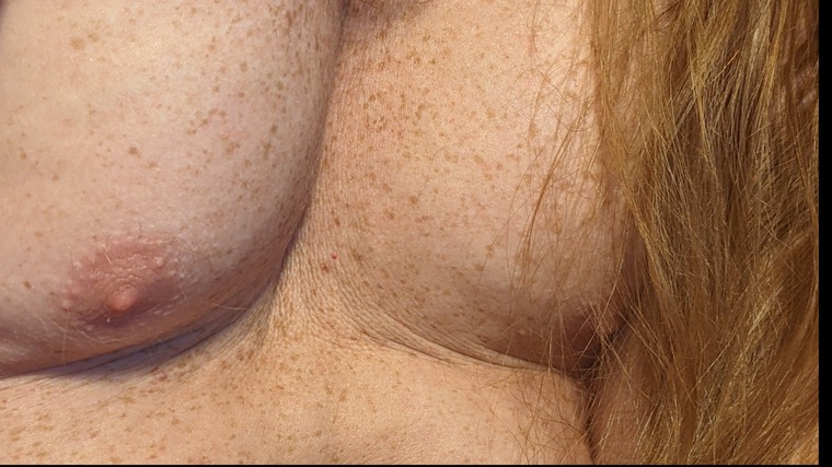 Medullan cover image