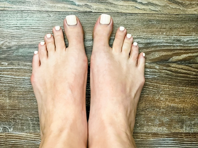 MT cover image