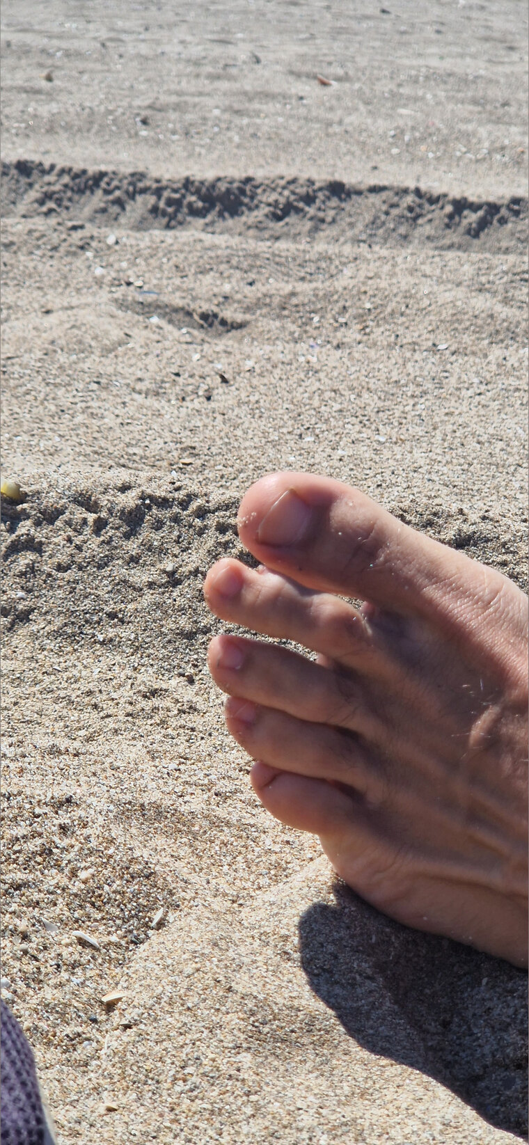Toe banner image
