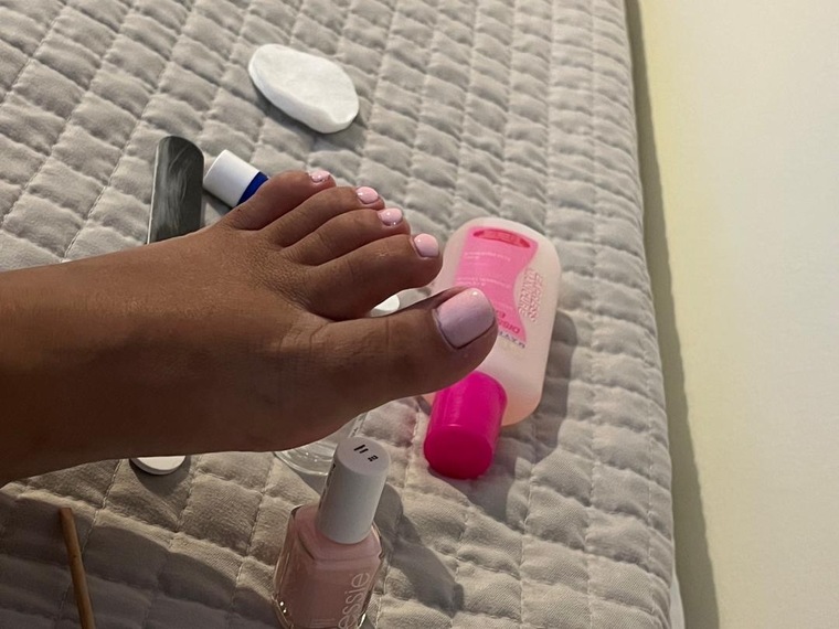 Miasfeet banner image