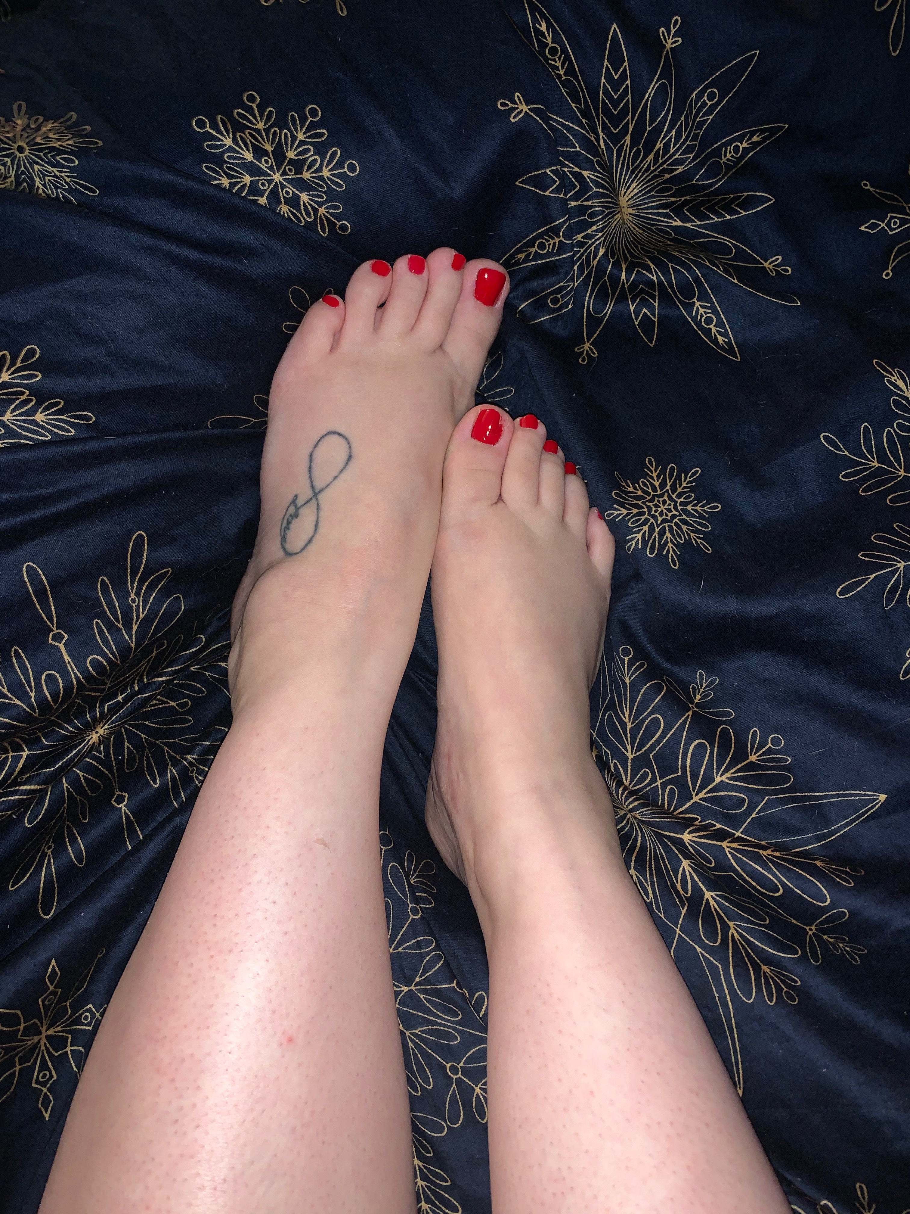 Misula’s feet banner image