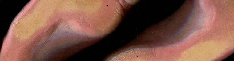 Myfeetyourfriend cover image