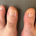 MyUglyFeetAUS avatar