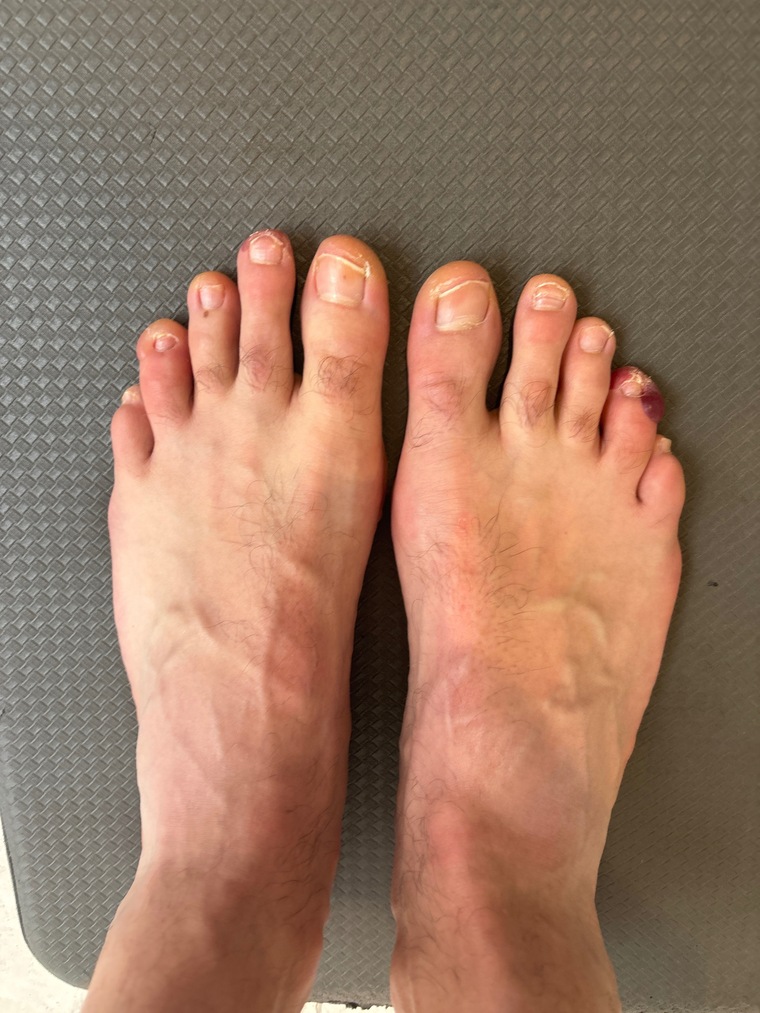 MyUglyFeetAUS cover image