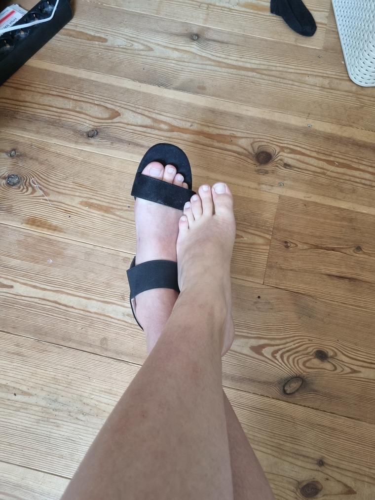Myweirdlittlepinkytoe cover image