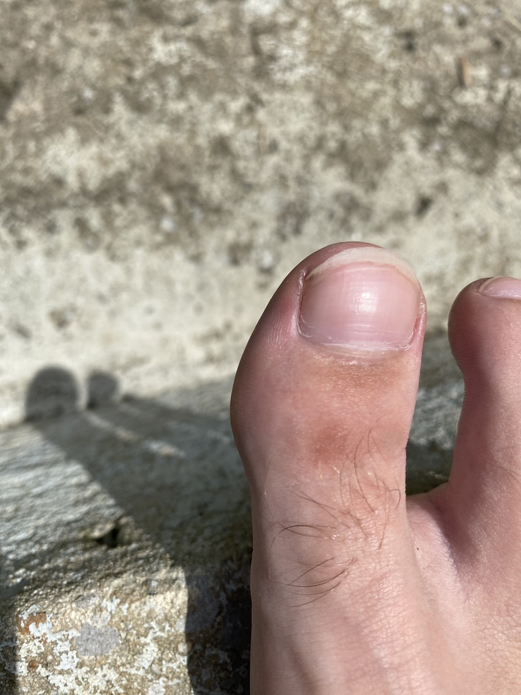 Ogmudtoe cover image