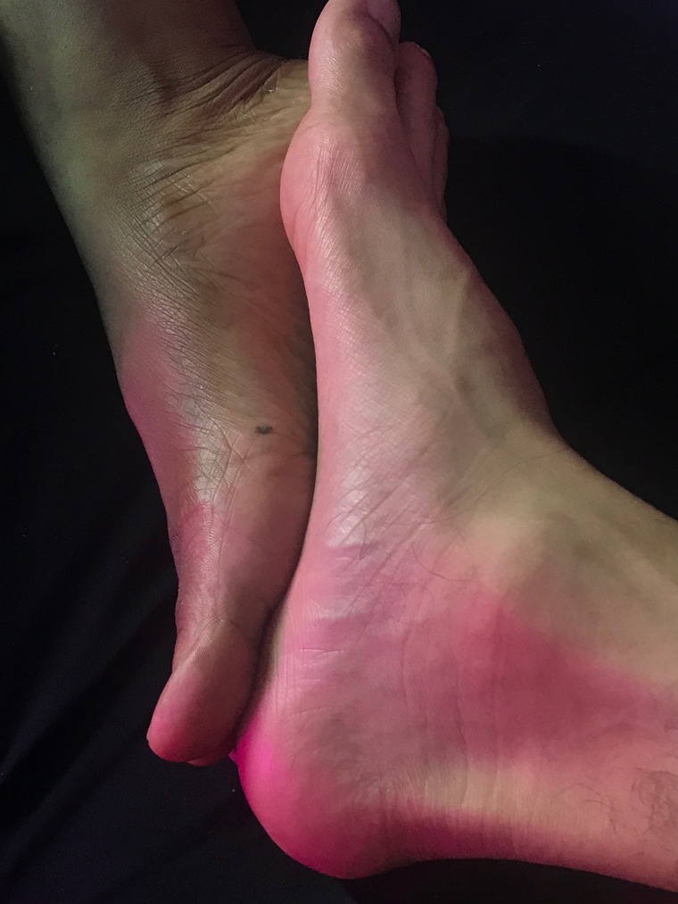 only patitas cover image