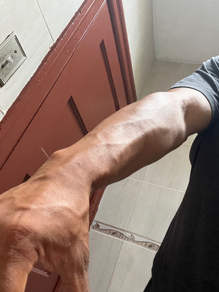 OnlyArmsAndLegs cover image