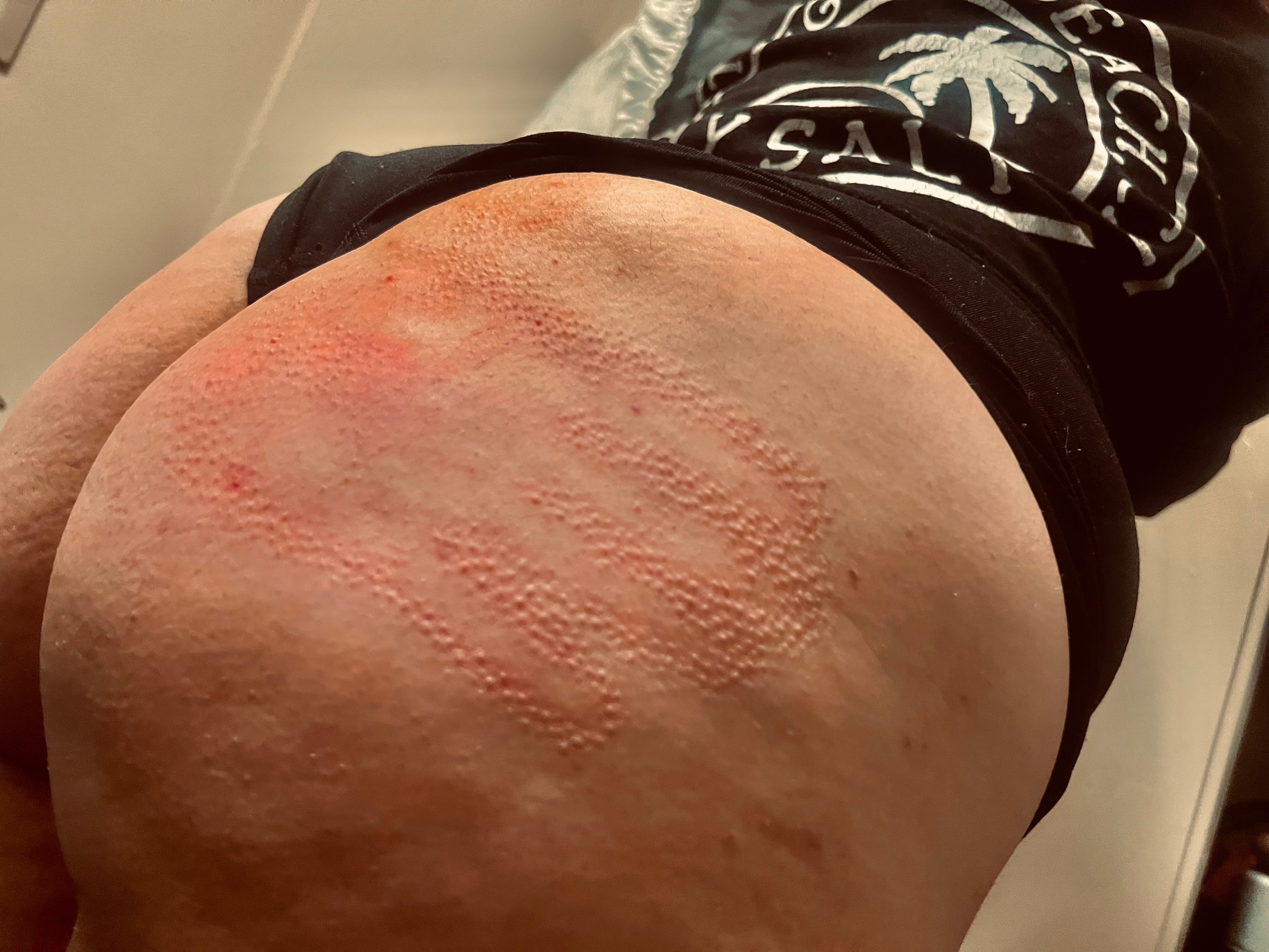 P96420 banner image