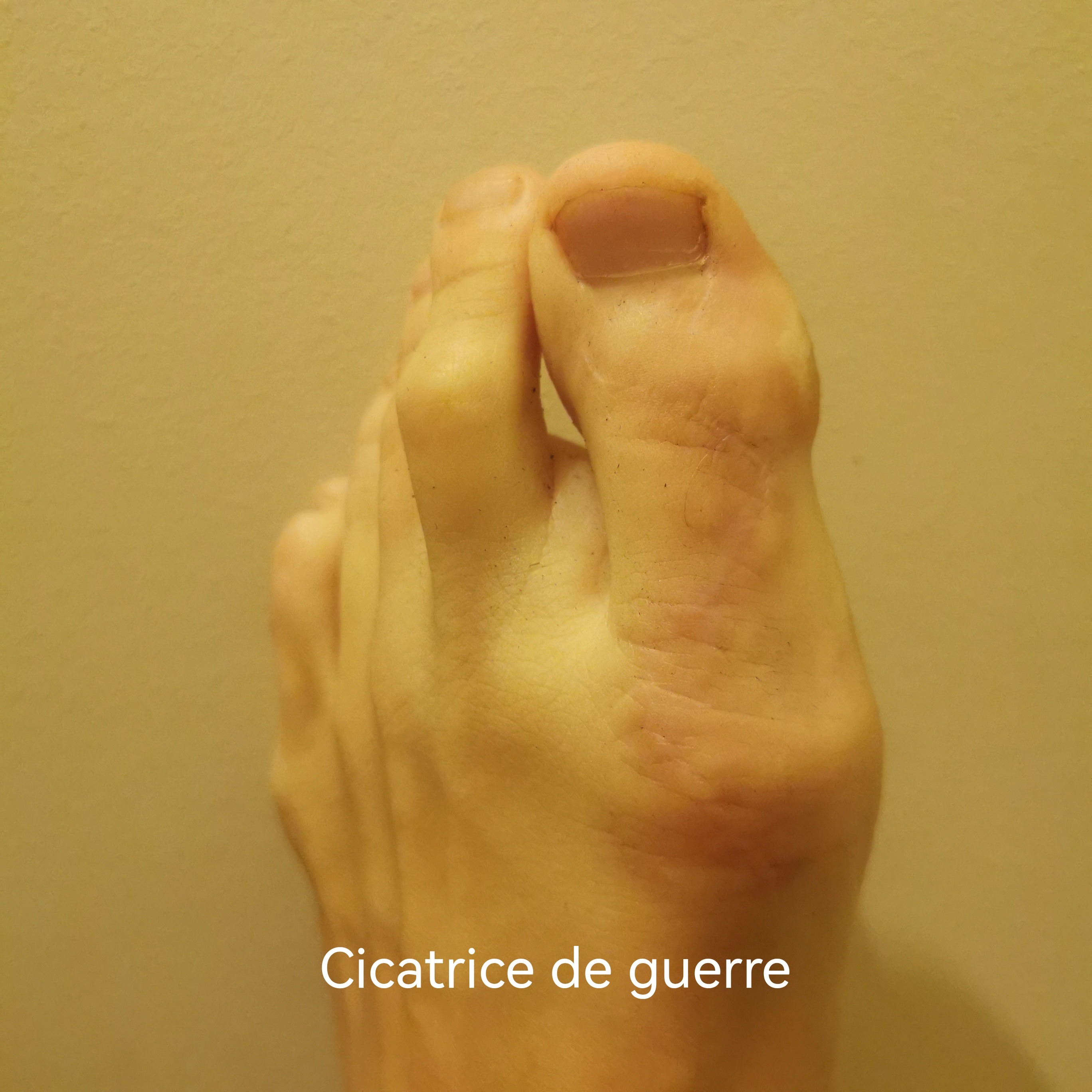 Piedtichiste banner image