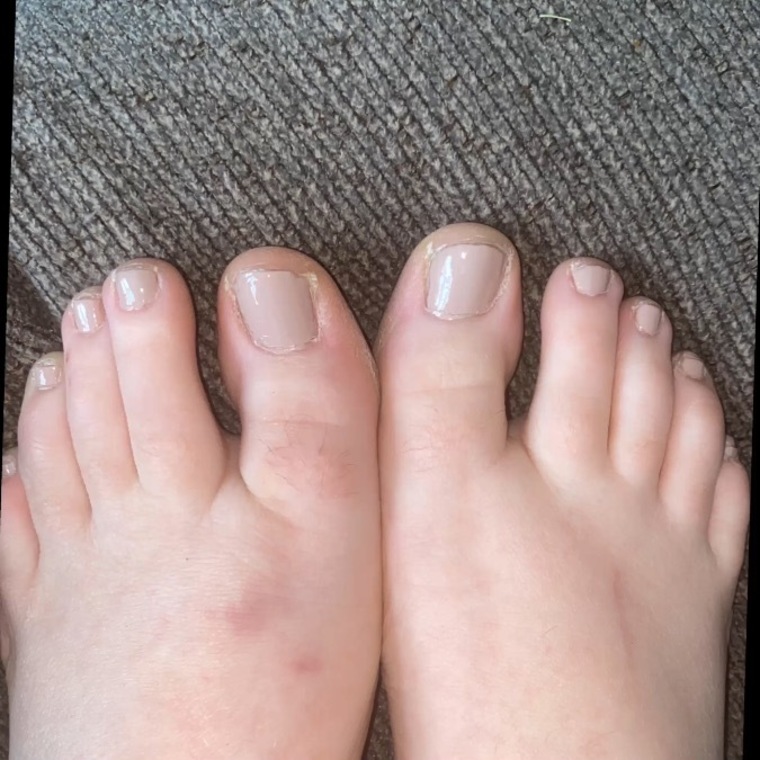 Long toes & feet🥰 banner image
