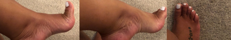 Ebony Feet & Toes ✨ BBW ✨ Foot Fetish cover image
