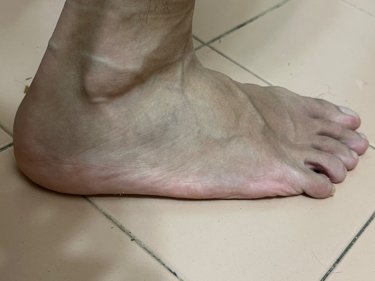 PRSkinnyFeet banner image