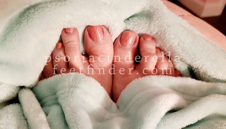 psoriacinderella cover image