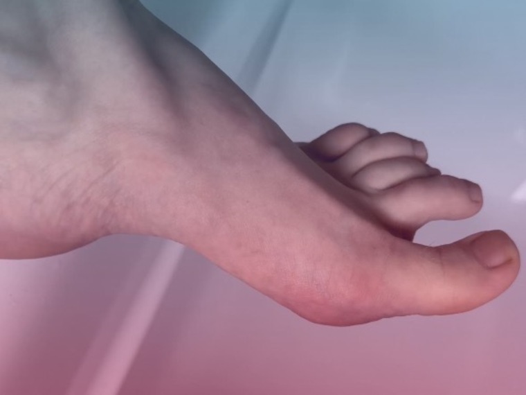 Psych Nurse Feet 👣 cover image