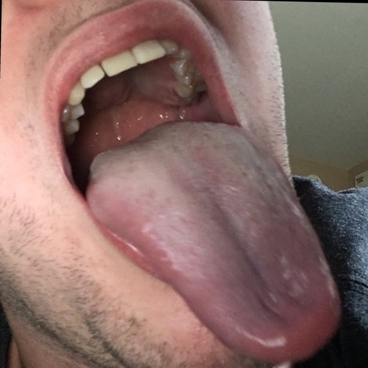 RavenousGiant banner image