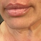 RealLips1075 avatar