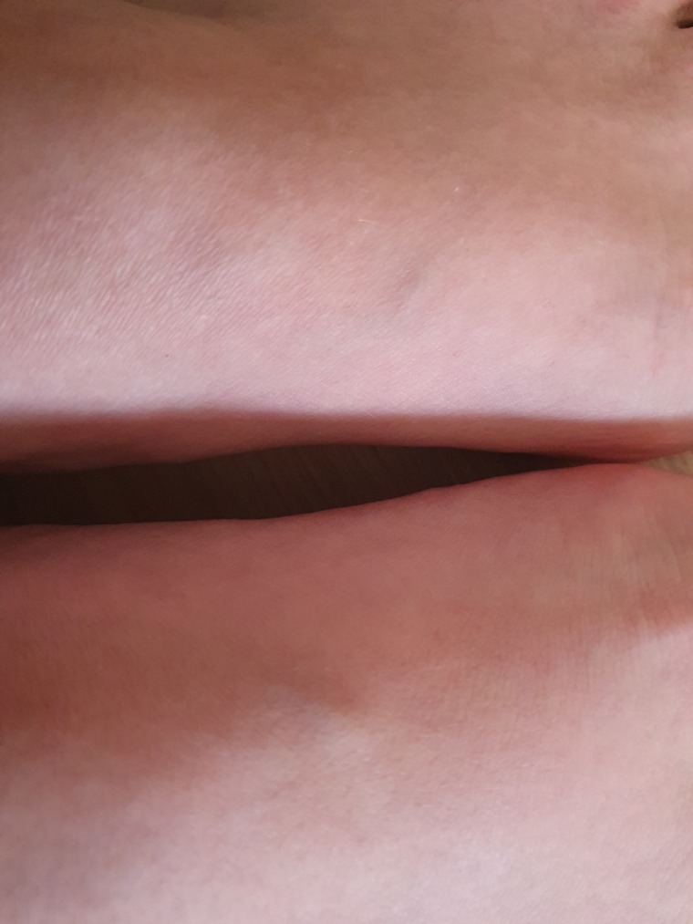 Redhead Feet banner image