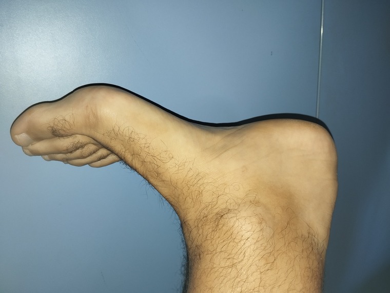 Man Feet cover image