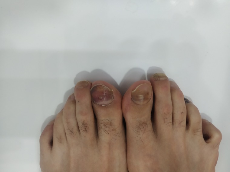 Running Feet Fantasy banner image