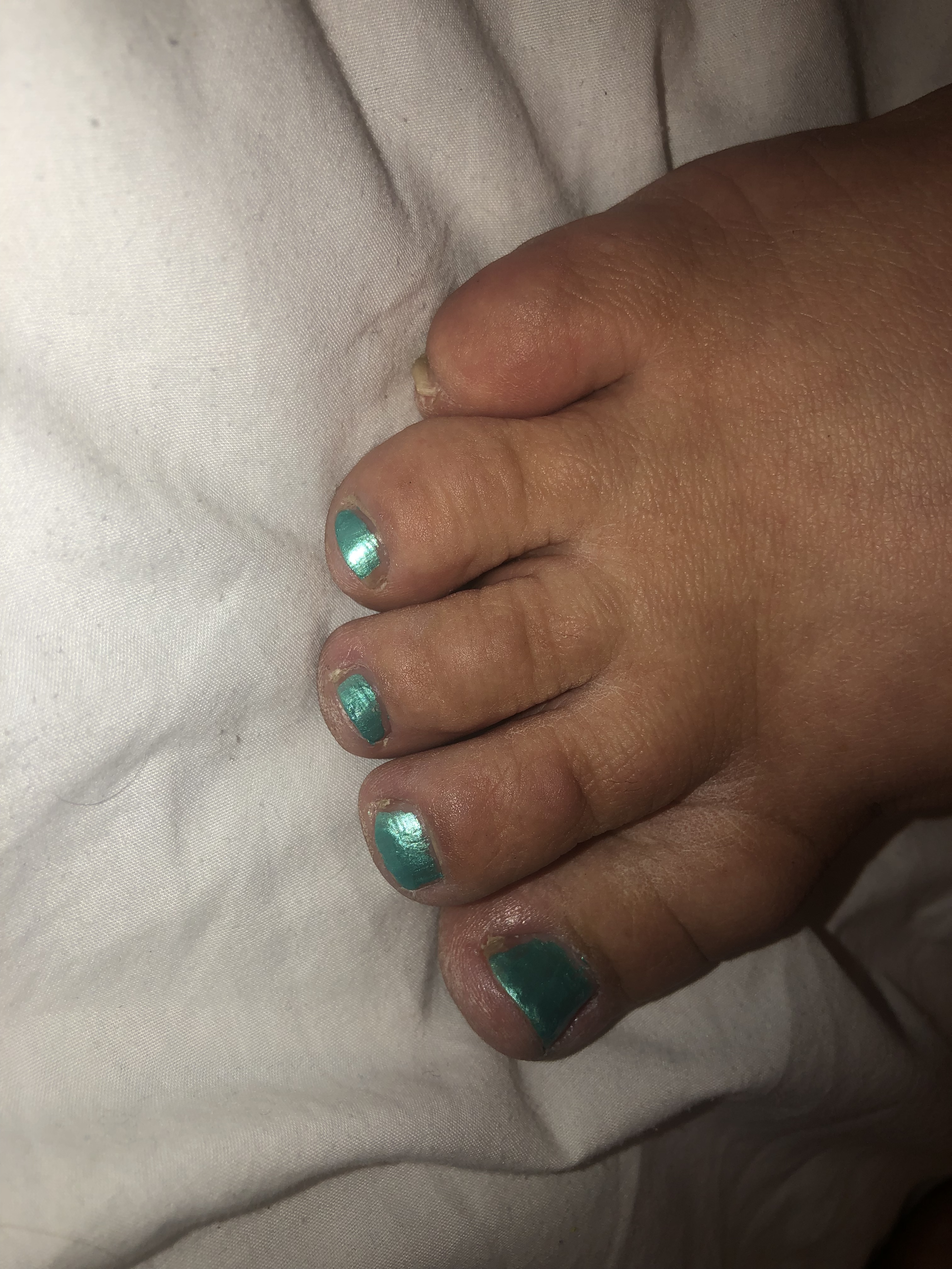 Secret feet banner image