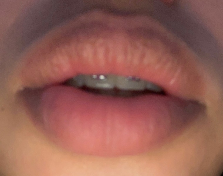 Big Lips sexy π«¦π banner image