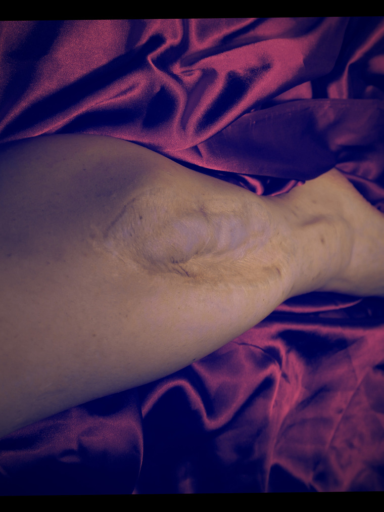 Sexy with the Scars cover image