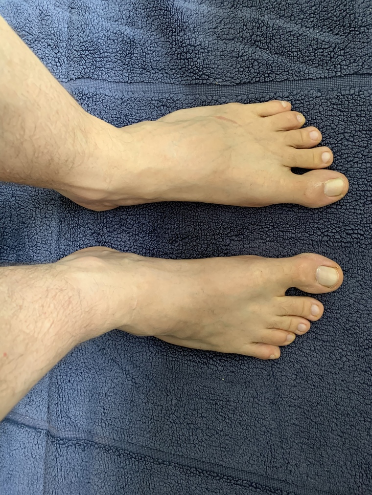 BigFeetSerb cover image