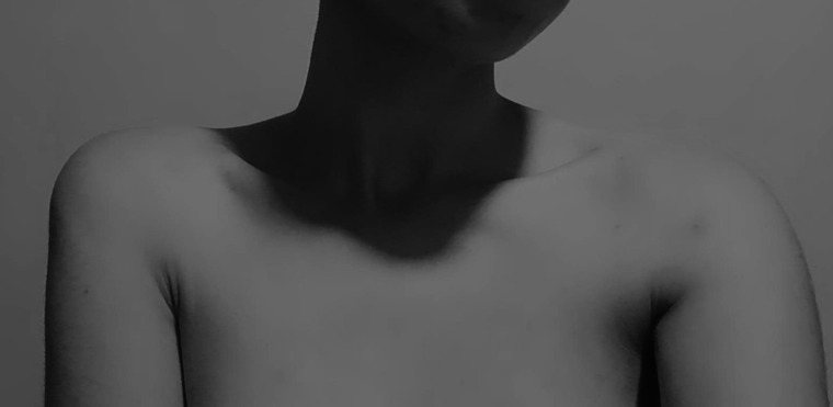 Skinny babe cover image