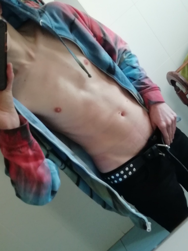 Skinny_dog banner image