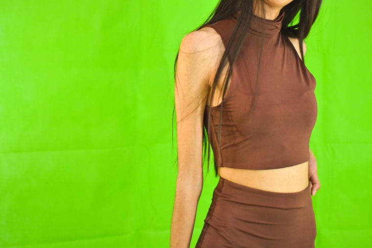 Skinny Alisson SQRT cover image