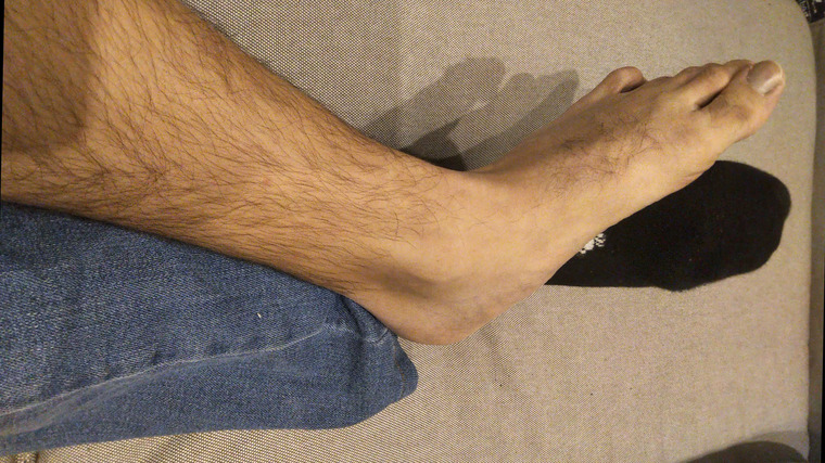 Skinnyfeetman banner image