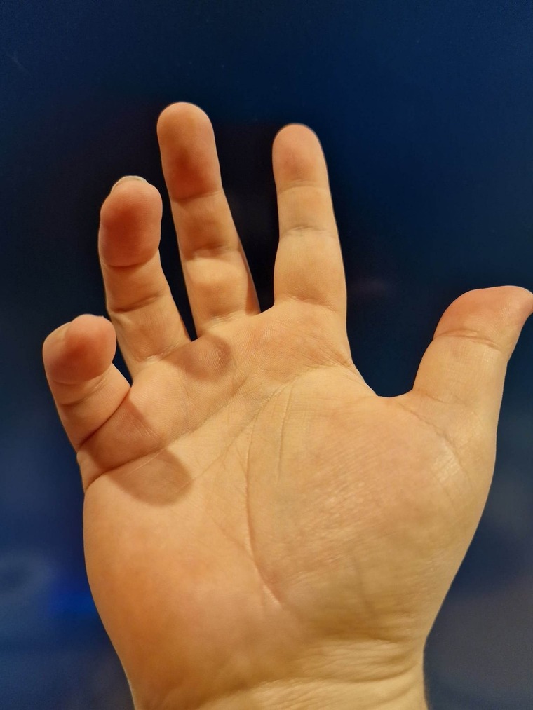 SolidHands banner image