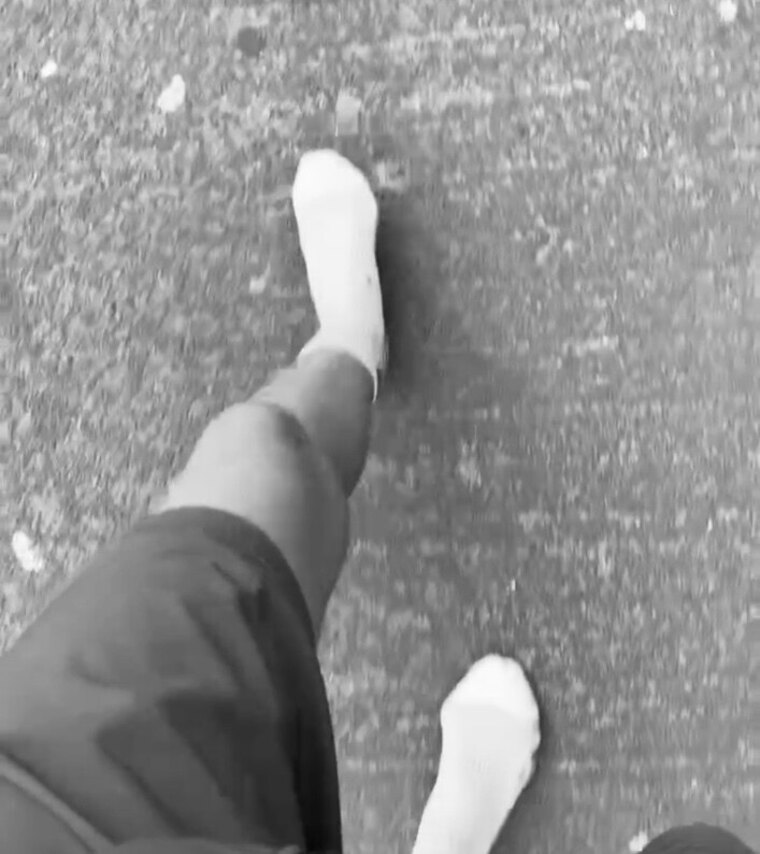 SpiceFeetbunions cover image