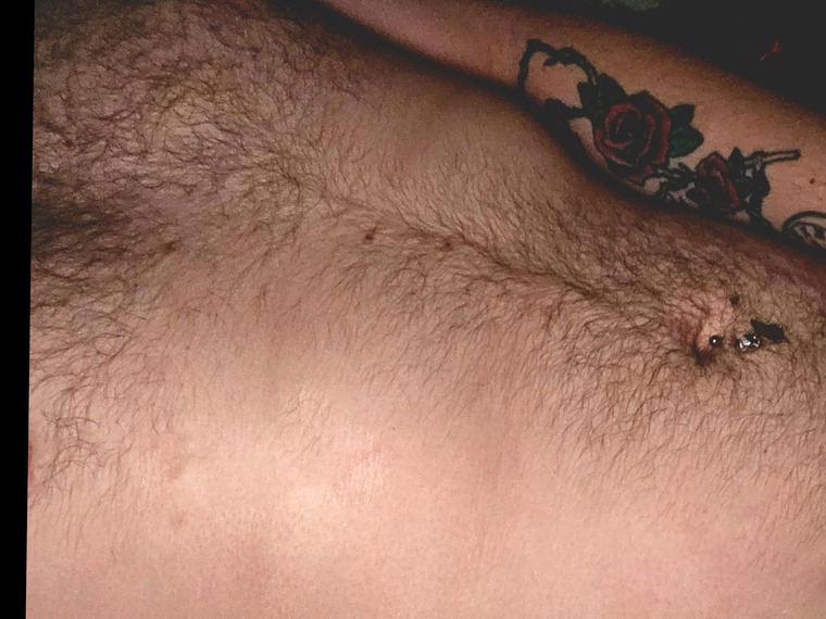TherapenisXXX cover image