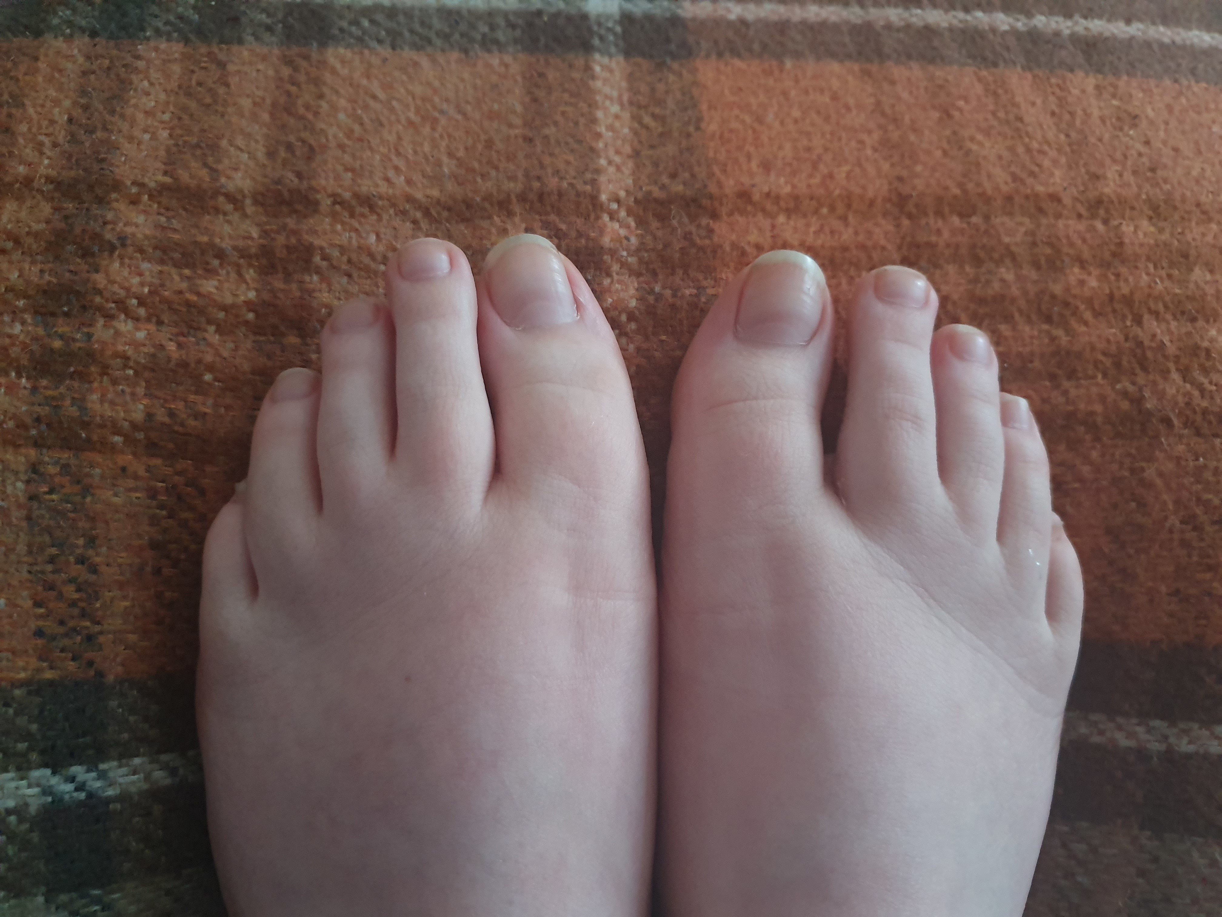Toe hoe banner image